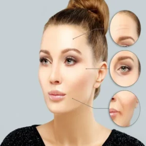 بوتاکس کامل صورت